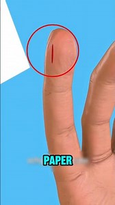 What You Should ACTUALLY Do After a Painful Paper Cut (Most People Make It Worse)