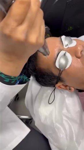 Juvon Skincare & Wellness on Instagram: "Achieve a flawless celebrity glow with Hollywood Laser Spectra ✨ This cutting edge laser facial helps reduce pigmentation acne marks uneven skin tone and dullness revealing brighter smoother and healthier looking skin. It is a safe non invasive treatment loved for instant glow and lasting skin rejuvenation. Ideal for laser skin brightening pigmentation treatment acne scar reduction and overall laser facial rejuvenation. Get camera ready skin today. Book y