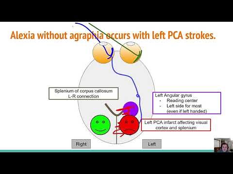 Strokes: Alexia Without Agraphia