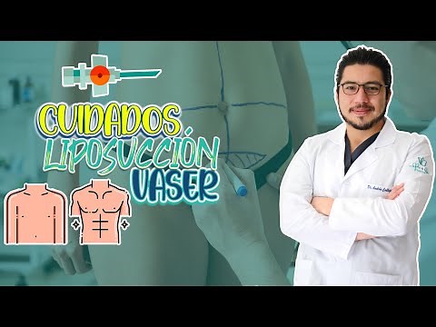 Cuidados después de una Liposucción Vaser