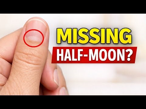 Small or Missing Half Moon Nails — What Your Body Is Really Telling You