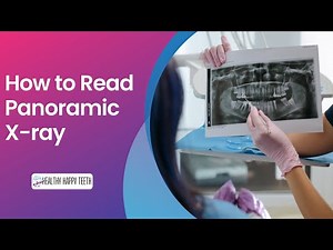 How to Read Dental Panoramic X-ray