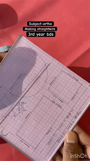 #music#ytshorts#motivation#nature#bds#dentist#orthodontics#wirebending#straightwire#19guage#glasslab