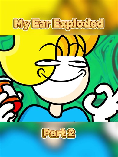 My Ear Exploded - Part 2 #Haminations #ear #exploded #us #funny | hydrogen peroxide in ear