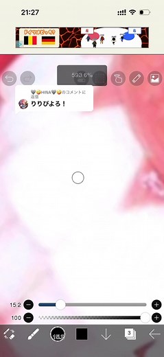 KOGYARU代表の歯リクエスト