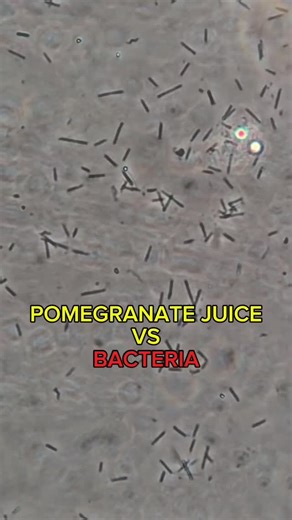 The Microscopy Lab on Instagram: "POMEGRANATE JUICE VS BACTERIA THE MICROSCOPY LAB 🔬 . . #juice #pomegranate #fruits #microscope #lab #reels #amazing #instagood #instagram #instagram"