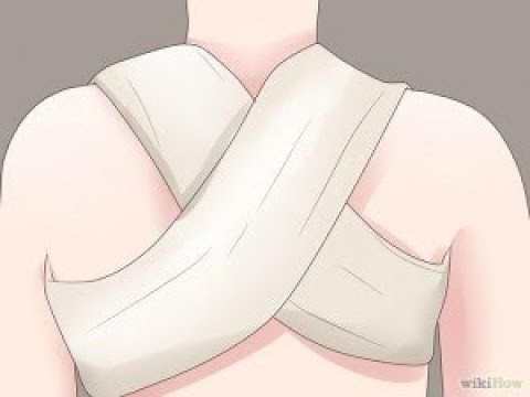 VENDAJE EN “8” POR FRACTURA DE CLAVICULA