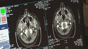 Overcoming the stigma of mental illness