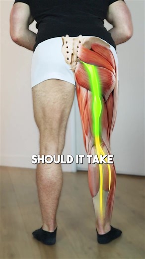 Sciatica Recovery Time: What to Expect