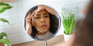 How To Get Rid Of Whiteheads, According to a Board-Certified Dermatologist