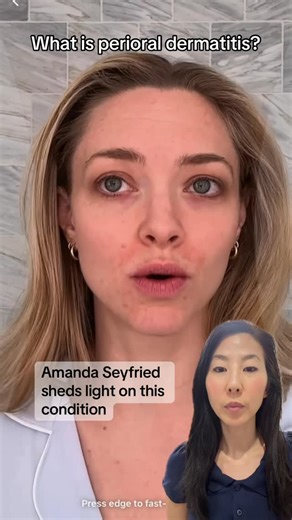 Dr. Janet Ip MD | What is Perioral Dermatitits? And how do we treat it? I just love Amanda Seyfried (especially since she played the mandolin and sung a... | Instagram
