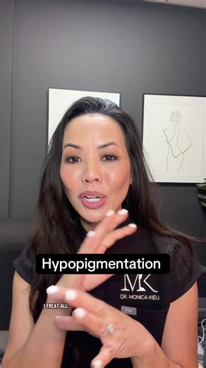 Replying to @bob the type of hypopigmentation I’m referring to in this video is post-inflammatory, but keep in mind that hypopigmentation can due to a variety of causes, for example is can be from an autoimmune condition (vitiligo) or fungal (tinea versicolor). Make sure you get evaluated by a professional to determine the cause, as this dictates treatment! #drkieutips #hypopigmentation #skincare #lasers