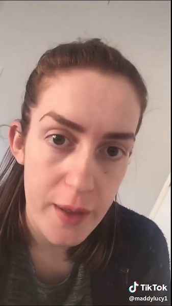 Megan Fox Toe Thumb: Nail Fail with Gel Nails Revealed