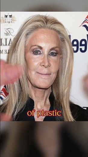 joan van ark's transformation: before & after plastic surgery 🌟✨ #celebritynews #movie #celebrity