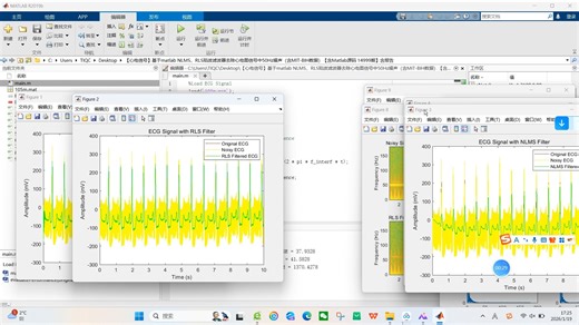 【心电信号】基于matlab NLMS、RLS陷波滤波器去除心电图信号中50Hz噪声（含MIT-BIH数据）【含Matlab源码 14999期】含报告