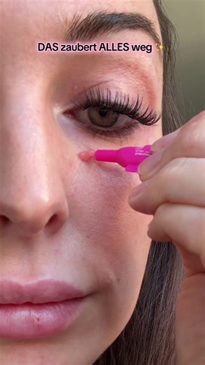 Effective Eye Bag Hacks to Eliminate Dark Circles