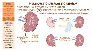 Video: Congenital renal disorders: Pathology review - Video Explanation! | Osmosis | Osmosis