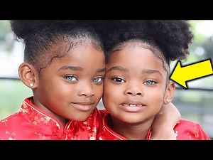 Remember the World’s Most Beautiful Black Twins Here’s What Happened to Them!
