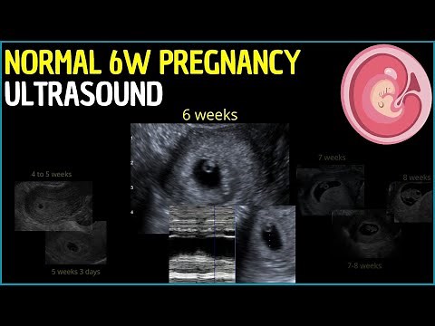 Early Glimpse: 6-Week Pregnancy Ultrasound Revealed!