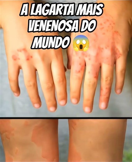 A LAGARTA mais venenosa do mundo 😲 #curiosidades