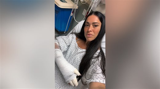 LA reporter burned after portable charger explodes