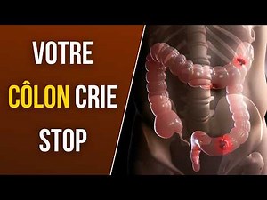Côlon irritable : 4 règles qui changent tout