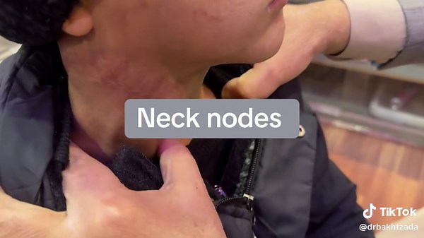 #neck nodes#cancer#PeshawarENT #DrBakhtZada #Rhinoplasty #