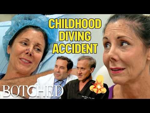 Pam Destroyed Her Nose 30 Years Ago Diving Into A Shallow Pool (Before & After) | Botched | E!