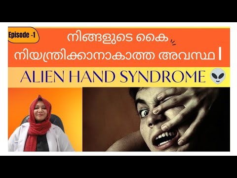 കൈ തനിയെ ചലിക്കുന്നു?Strange Medical Condition – Episode 1 | Alien Hand Syndrome 😱