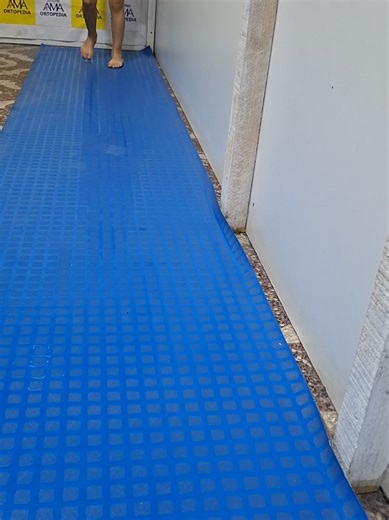 anteversion femoral #tratamiento #ortopediainfantil #fisioterapi #traumatologia #fyp