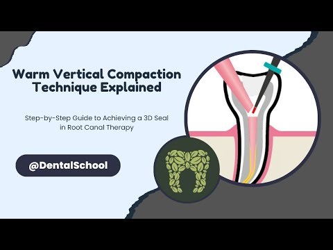 Mastering Warm Vertical Compaction: Step-by-Step Guide for a Perfect Seal