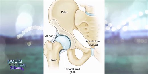 Hip impingement: symptoms, treatments, and more