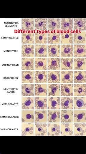 defferent type of blood cells