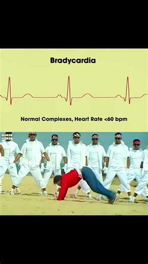 👉 “ECG Made Simple | Understand ECG Basics in Minutes | No More Fear of ECGs!””