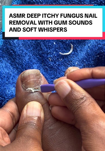 Satisfying Toenail Cleaning ASMR Experience