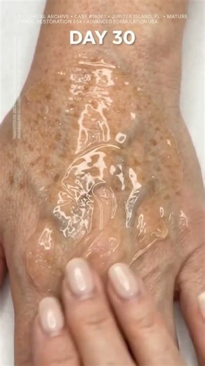 The look of bulging hand veins and thin crepe visibly smoothed with a 90-day routine! 30-Day
