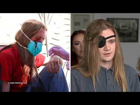 USC student prepares to sue DHS after losing eye during 'No Kings' rally