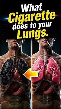 What Smoking Does to Your Lungs Over Time 🚬🫁