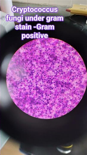 cryptococcus fungi under gram stain