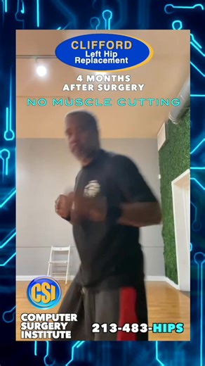 💚 Computer-Assisted Hip Replacement by World Leading Surgeon Dr. William T. Long. SMALLER INCISION GREATER PRECISION 🟢 Mini-Incision 🟢 No Muscle Cutting 🟢 Rapid Recovery 🟢 Better Long-term outcomes See Real CSI Patients 🌐 orthocsi.com/hipreplacements 📲 213-483-HIPS #wellcare #UHC #skydance #paramountplus #wsop #AAOS2025 #totalhipreplacementjourney #totalhipreplacementrehab #hipwarrior #hipphysio #injuryrecovery #injuryrecoveryprogress #surgeryrecovery #hipreplacement #hippain #hiprehabili