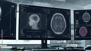 Futuristic Medical Scan Software Inspects Human Brain To Diagnose Illness. Medical Scan Software Examines Organ For Damage. Inspecting Patient Head With Advanced Medical Scan Software. Neurologic