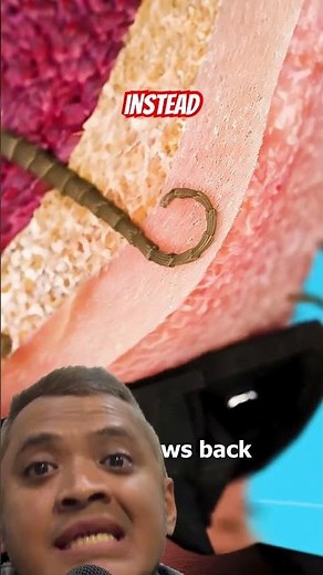 Razor Burn Explained - source ⁨@zackdfilms⁩