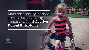 3-year-old Madison to get life-changing surgery