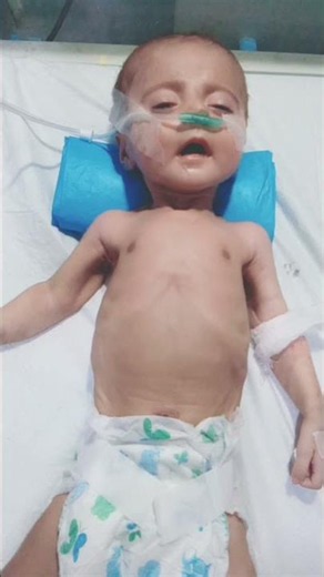 critical condition baby in NICU/NICU journey