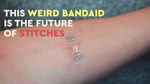 This new 'skin-closure device' could replace stitches entirely. (From Morning Dose TV) | Dose