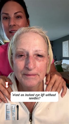 👏All in...MINUTES!👏 With Plexaderm Rapid Reduction Serum, under-eye bags, puffiness, and wrinkles are visibly reduced in minutes. Hello, bright and refreshed look! #EyeTransformation #RapidResults #Plexaderm #FYP #plexadermpartner