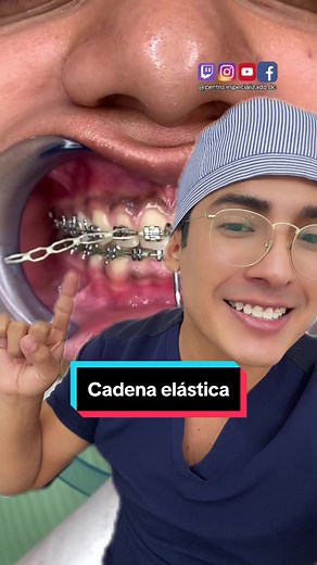 Dolor y molestias en brackets: cómo enfrentar la cadena elástica