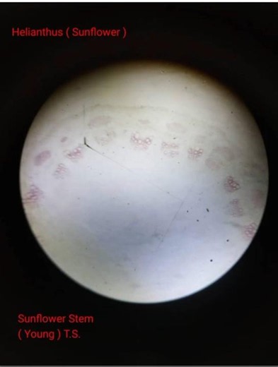 Internal Structure of Dicot Stem and Monocot Stem