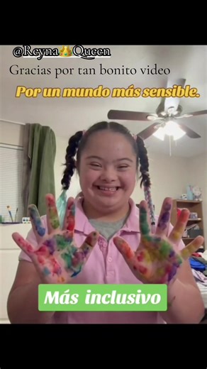 Un bonito video que nos mandaron #disability #discapacidad #sindromededown #trisomia21 #video