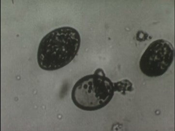 Life Cycle of Diphyllobothrium Latum (1950)